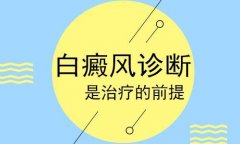 學會自我觀察白癜風 讓白癜風無所遁形